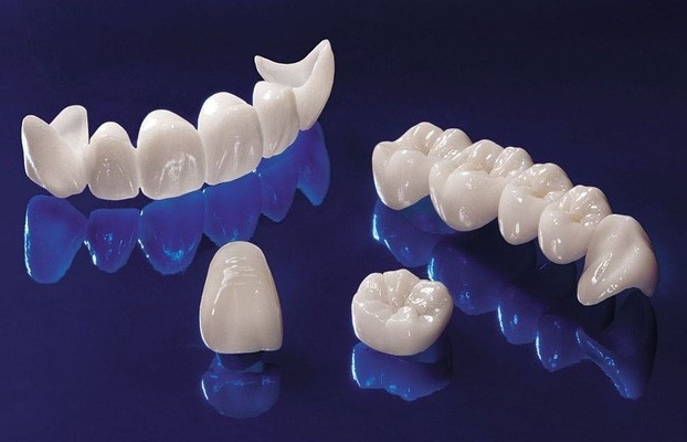 Thuế giá trị gia tăng mặt hàng đĩa phôi sứ làm răng giả